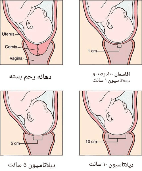 علائم شروع زایمان