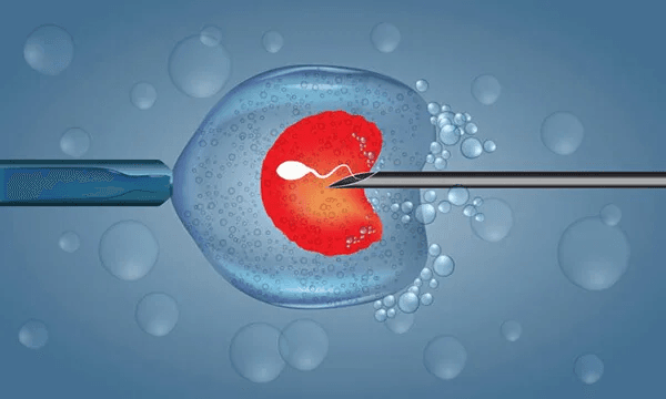 لقاح خارج از رحم یا IVF