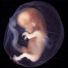 چه مدت بعد از سقط جنین می‌توان باردار شد؟